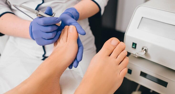 professional toenail fungus treatment