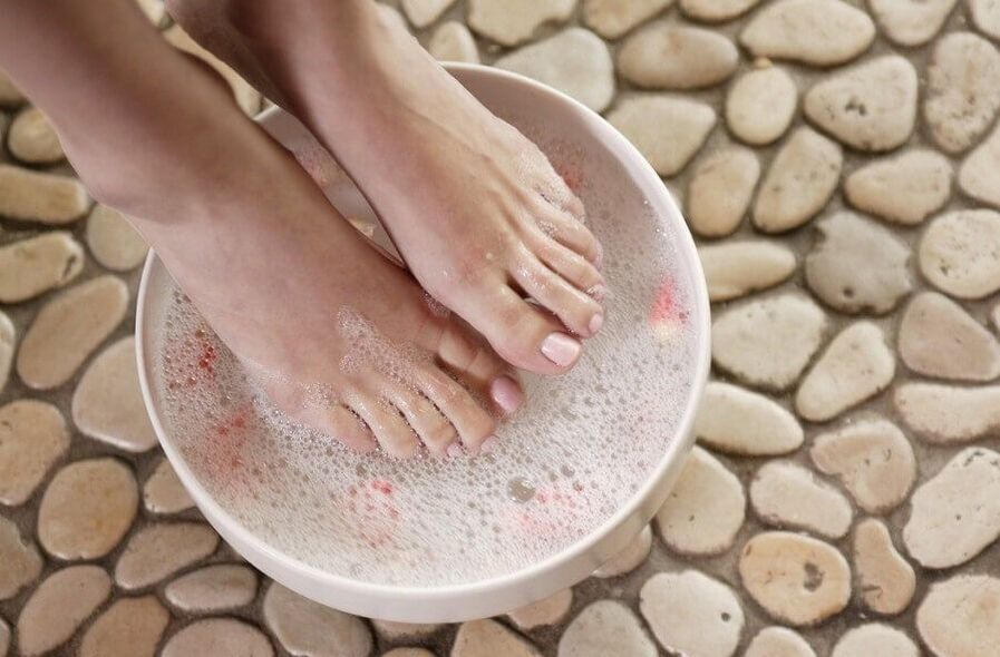 fungus baths